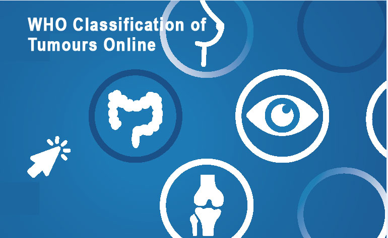 WHO Classification of Tumours Online
