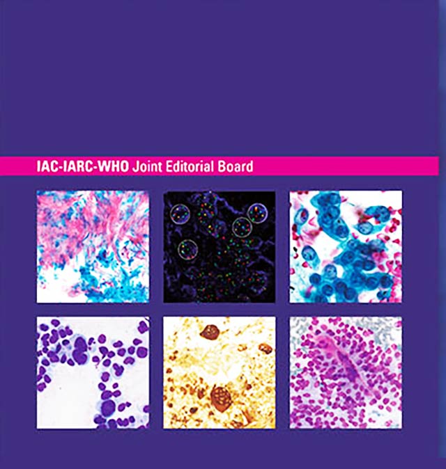 Publication of the IAC-IARC-WHO Cytopathology Reporting Systems, 1st Edition, Volume 2: WHO Reporting System for Pancreaticobiliary Cytopathology
