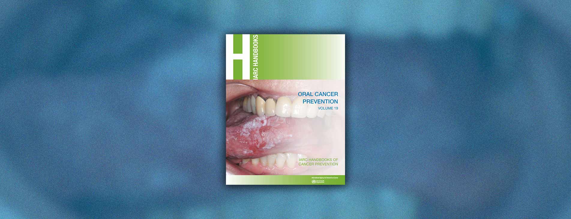 Profilaktyka raka jamy ustnej – IARC